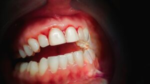 dientes perfectos las tablas madrid