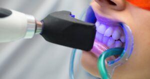 blanqueamiento dental las tablas madrid